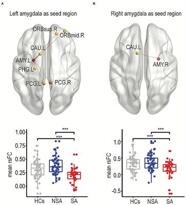 Discriminating Suicide Attempters and Predicting Suicide Risk Using Altered Frontolimbic Resting-State Functional Connectivity in Patients With Bipolar II Disorder